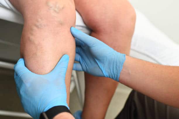1773421369_istockphoto-1370455164-612x612-1 Vein Disease Diagnosis in Munster, IN