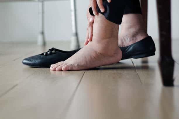 Elderly woman swollen feet putting on shoes Leg & Ankle Swelling Treatment in Munster, IN